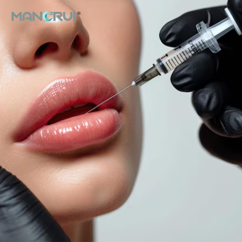 Hyaluronic Acid Injection - MANORUI