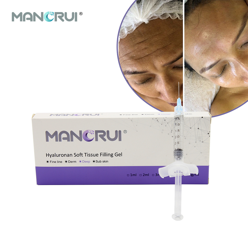 Hyaluronic Acid Injection - MANORUI